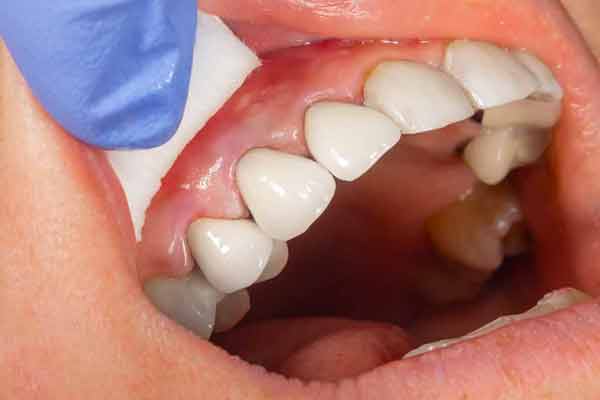estetico dentale