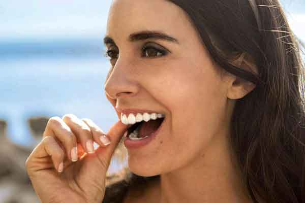 trattamenti invisalign
